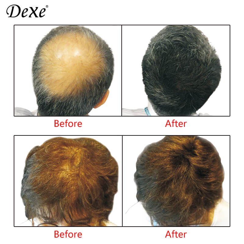 dexe hair building fiber
